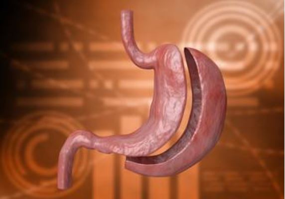 You are currently viewing Dr. Harsh Sheth Answers Common Questions About Bariatric Surgery
